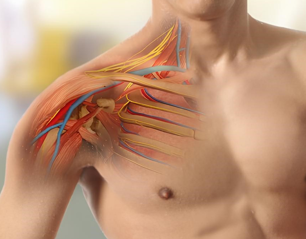 Brachial Plexus Surgery