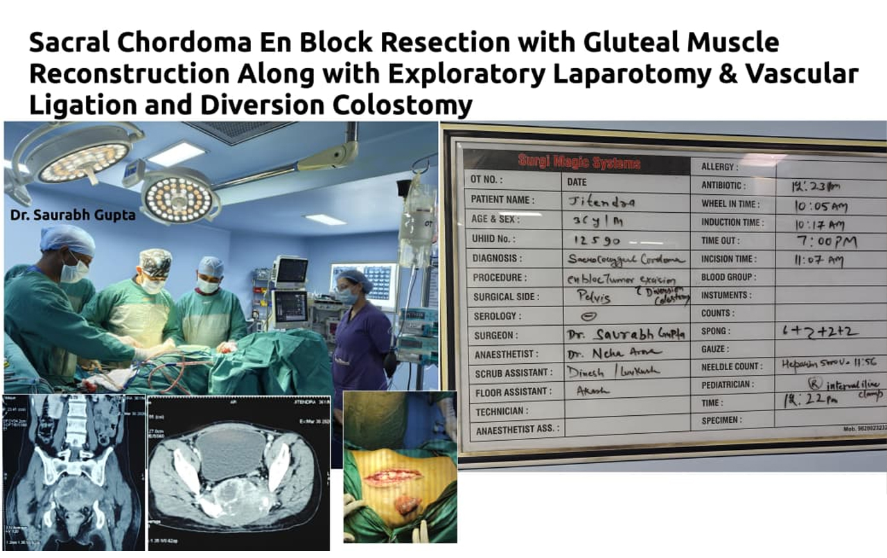 Cranio Facial Cleft Surgery