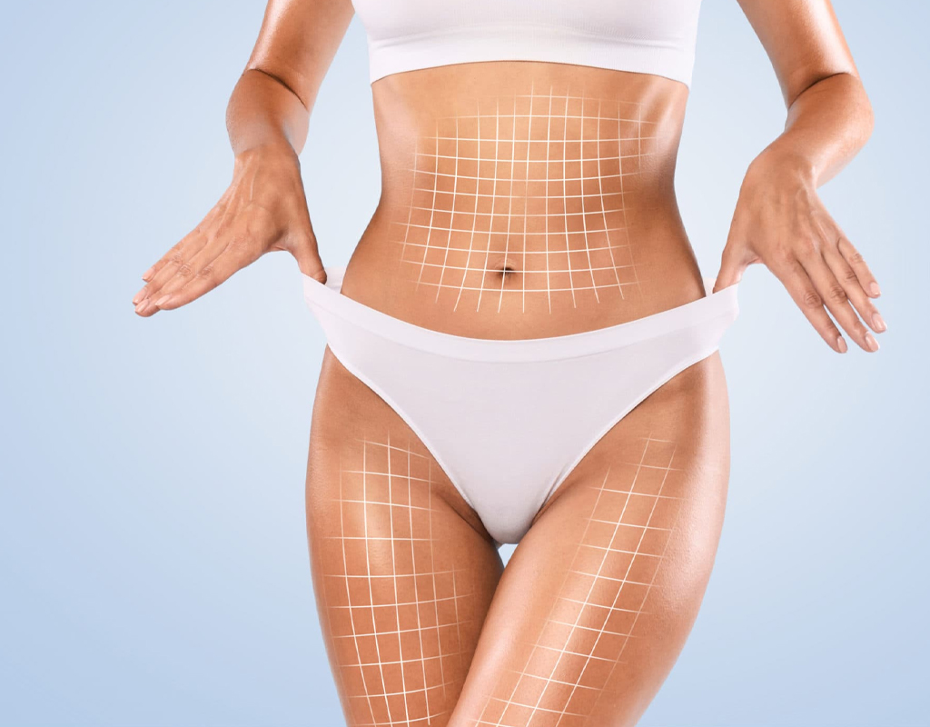 Body Contouring Surgery