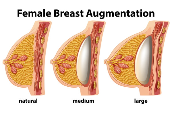 Breast Cancer Surgery