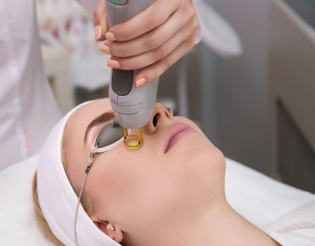 Laser Hair Transplant